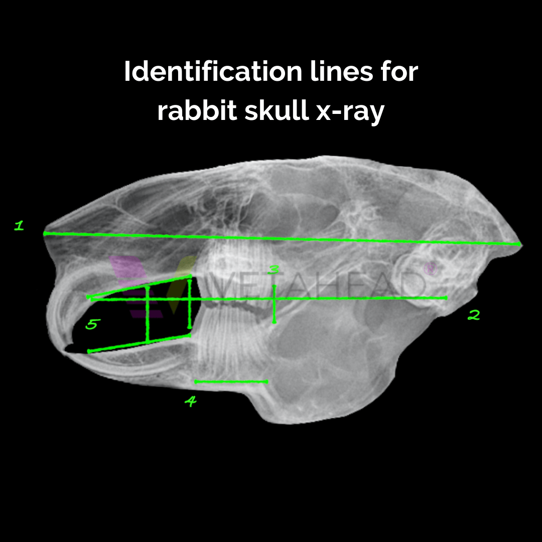 Skull x-ray interpretation